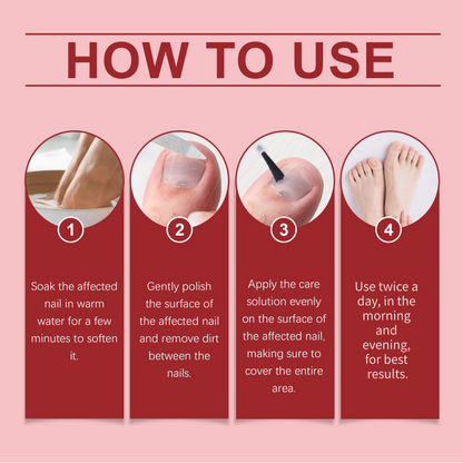 🔥Zeitlich begrenztes Weihnachtsangebot: 50 % RABATT!!!🔥 Nagel-Reparaturessenz für geschädigte Nägel